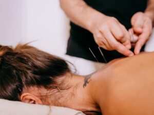 Acupuncture for Health Reducing Cholesterol with a Holistic Approach